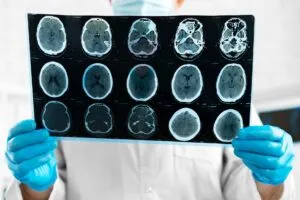Use of AI for Personalizing the Patient Treatment Options
